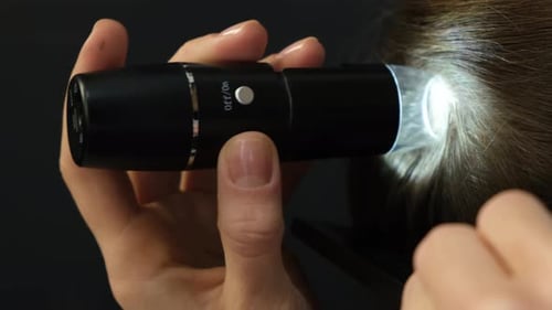 Closeup Diagnostic Complex for Microscopic Examination of Hair and Skin of the Scalp Trichoscope