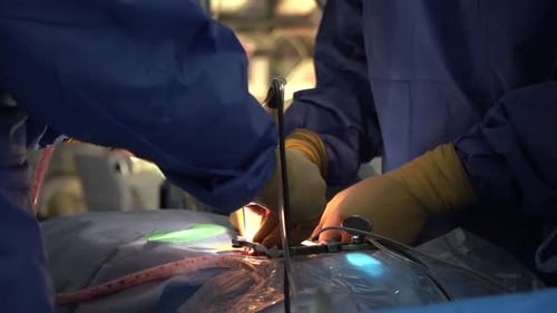 Surgeons Performing Medical Procedure in Operating Room