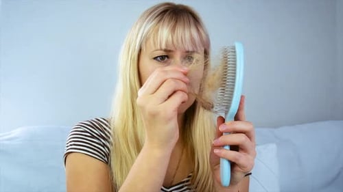 Hair Loss in a Woman