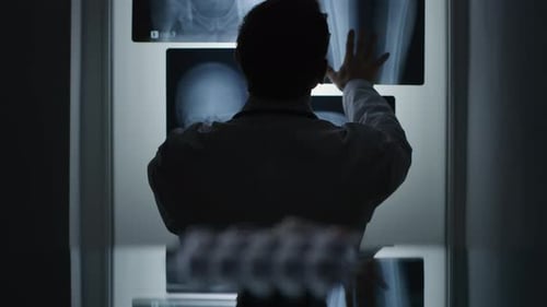 Doctor Examining X-Rays