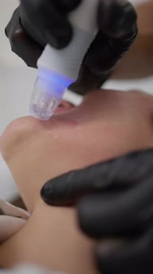 Medical Procedure for Skincare and Beauty