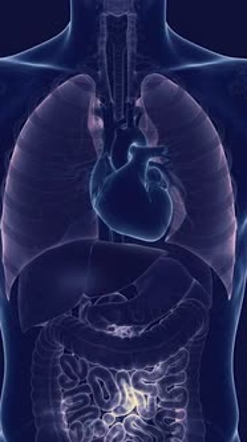 Cardiac Arrest - Loss Of Metabolic Heat Thermal Scan 3D Medical Animation | Manestream Den