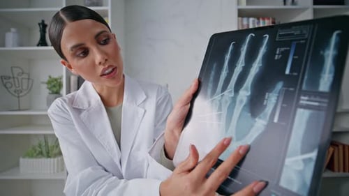 Woman Radiologist Viewing Bone Structure on Xray at Tablet Closeup Pov Video