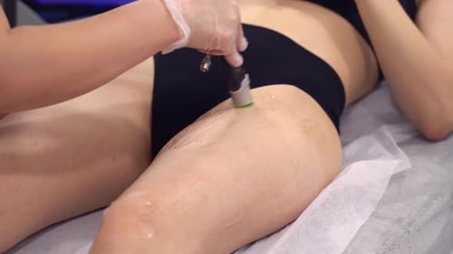 Alexandrite Laser in Aesthetic Medicine Woman on Laser Hair Removal Treatments Bikini Area