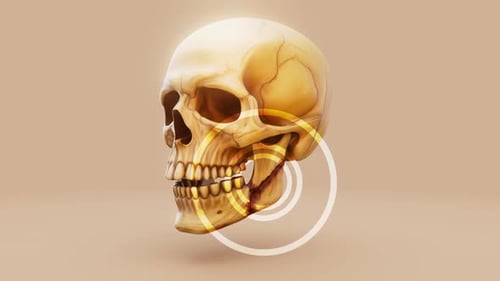 Konzeptionelle 3D-Animation einer Kieferfraktur
