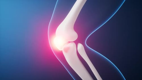 3D Human Knee Joint Pain and Inflammation Animation