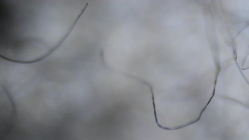 Fusselfilamente durch ein optisches Mikroskop