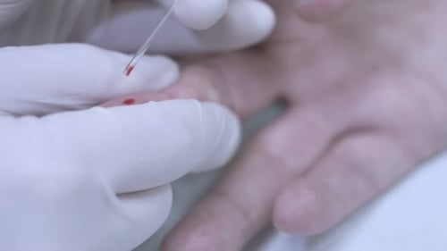 Finger blood collection close up for hiv testing process in medical care