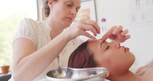 Des thérapeutes professionnels placent des aiguilles d'acupuncture sur le visage d'un client pour relâcher la tension musculaire faciale