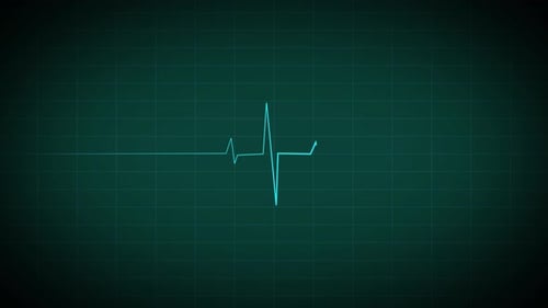 Animated ECG Heartbeat Line for Medical Displays