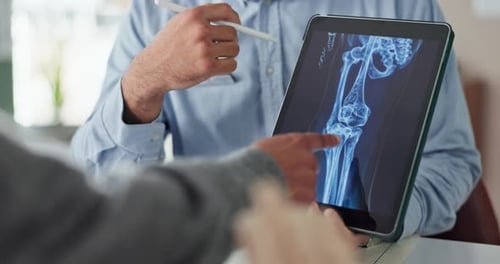 Doctor Reviewing Knee X-Ray with Patient