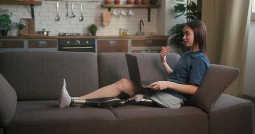 Young Woman with Prosthetic Leg Uses Laptop