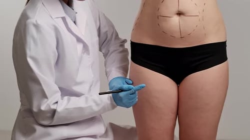 Doctor Marking Patient's Body for Surgery