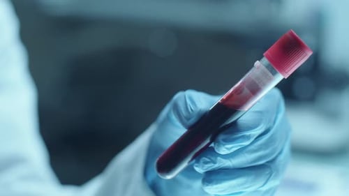 Blood Sample in Test Tube in Laboratory Setting