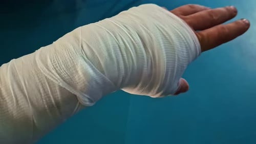 Bandaged Arm and Hand Close Up Medical