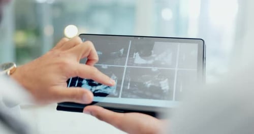 Doctor, hands and tablet with x ray in meeting, discussion or surgery planning together at hospital