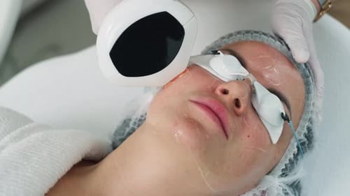 Woman Receiving Laser Facial Treatment Close Up