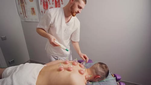 Cupping Therapy Treatment at a Doctor's Office