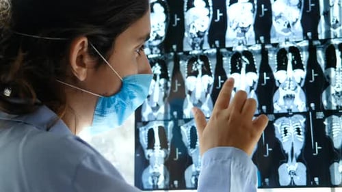 close up of female doctor discussing an MRI scan. analysing abdomen tomopgraphy.