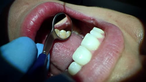 Dental Care Extreme Close Up Macro Video Dentist Treat Patient Teeth Orthodontist Works with