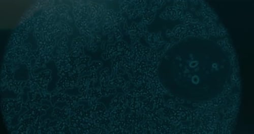 Cancer Cells Under Microscope At Laboratory