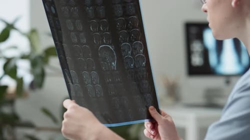 Young Adult Examines Brain Scan X-ray in Office