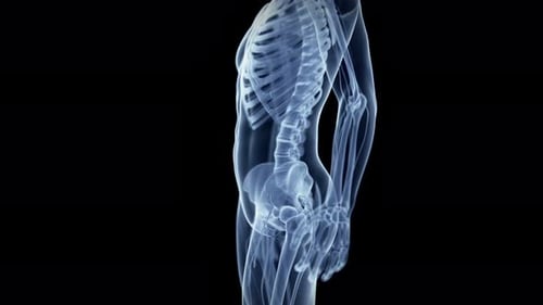 Medical animation of human hip joint pain in skeletal system