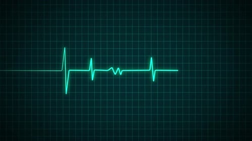 Animated Heart Rate Monitor ECG Line Display Loop