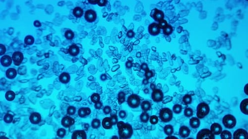 Microscopic Blue Particles and Bubbles Flowing Upwards