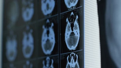Brain CT Scan Display