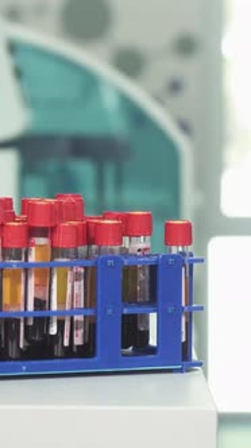 Blood Samples in Test Tubes for Medical Analysis