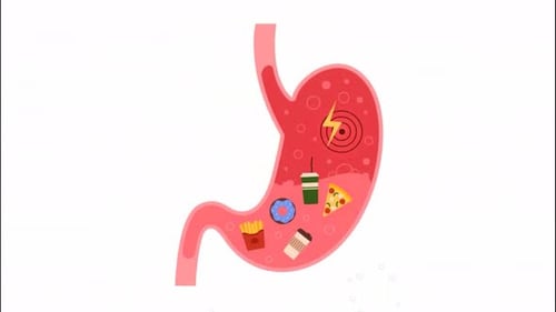 Fast Food Causing Heartburn & Indigestion in Stomach - Unhealthy Lifestyle