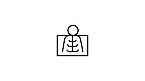 Minimalist Medical X-ray Icon Line Drawing Animation