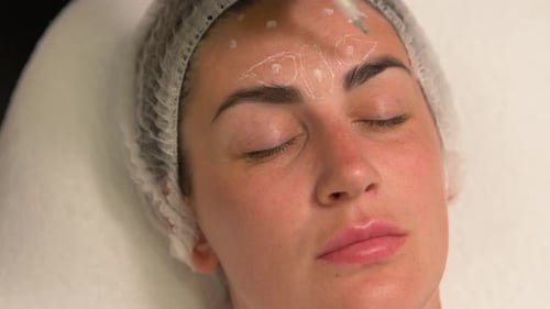 Woman Receiving Markings on Face at Cosmetic Clinic