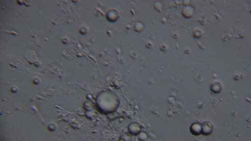 Microscopic view of spermatozoa, showing numerous round cells and a few with visible tails, moving