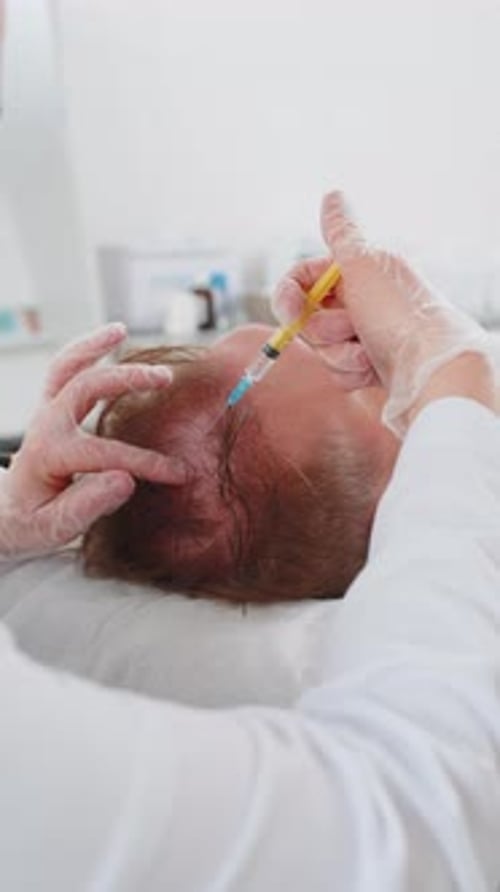 Trichologist Doing Man Hair Regeneration Procedure Dermapen Microneedling Vitamin Exosomes Injection