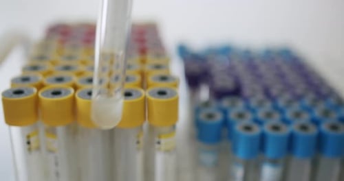Close Up of Hand Placing Test Tubes in Rack