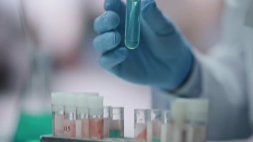 Doctor Hands Taking Sample Vaccine in Test Tube Working Laboratory Close Up