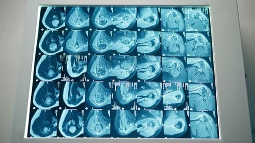 Examining Detailed Medical Scan with Pen on Screen
