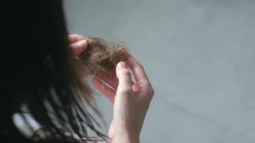 Woman Holding Fallen Hair Showing Loss and Alopecia Problem