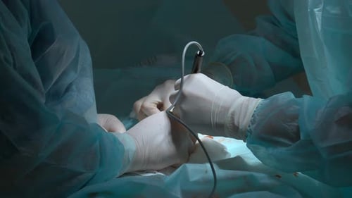 Close up of hands of surgeons team during operation with surgical laparoscopy instruments