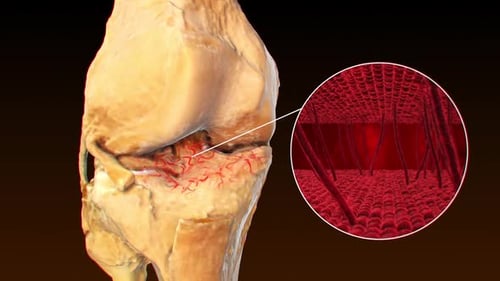 pain in the wrist bones