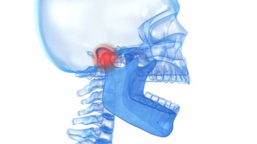 3D Human Skull Anatomy With Opening Jaw And TMJ Pain