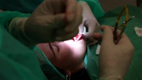 Intense Dental Procedure: Surgeon Stitches Gum During Surgery Close-Up