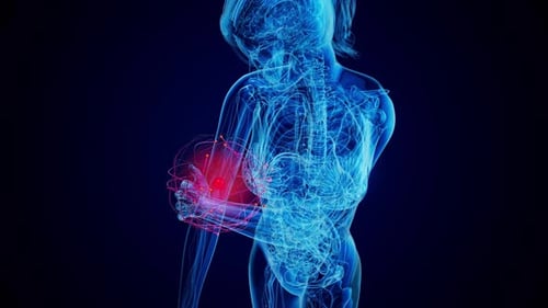 Futuristic Medical Scan of Human Arm Pain and Injury