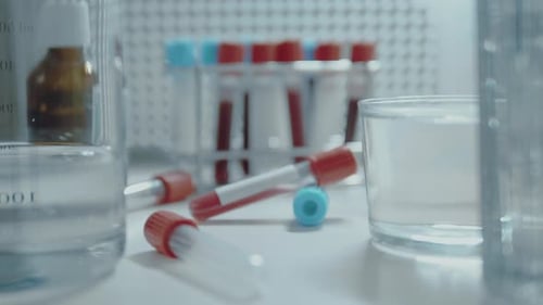 Blood Samples and Glassware in Medical Laboratory