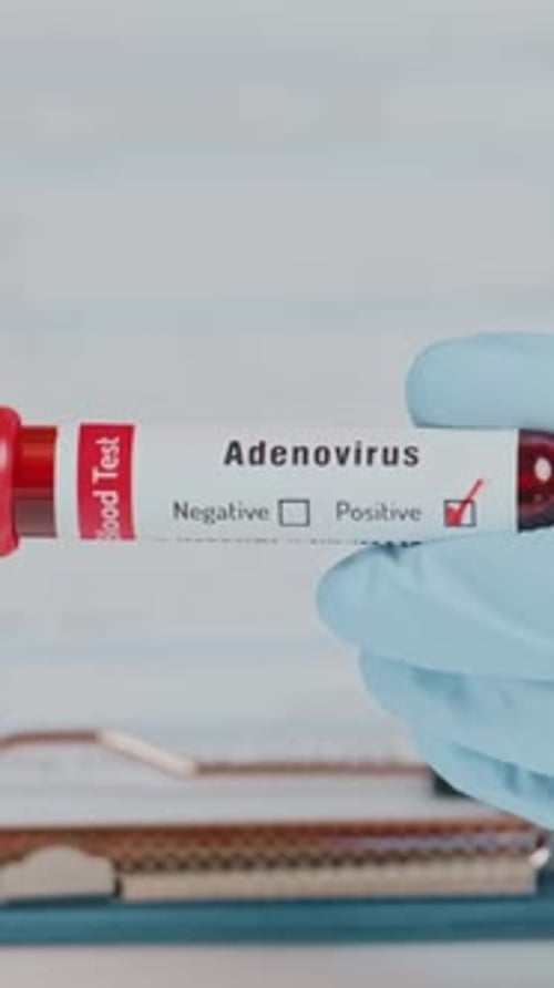 Adenovirus Blood Test Shows Positive Result