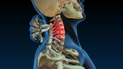 Animated Human Cervical Spine with Highlighted Pain Points