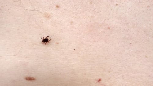 Kleine Insektenparasitenmilbe kriecht auf der Handfläche eines Mannes. Zecke auf der Haut aus nächster Nähe. Zecken tragen