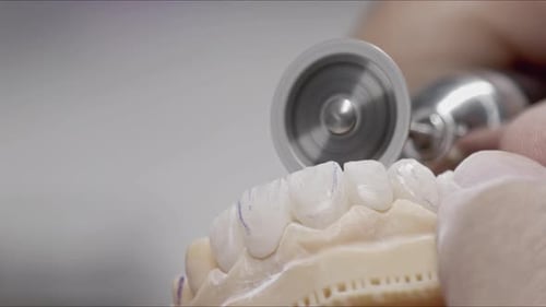 Close Up Grinding of Dental Veneers